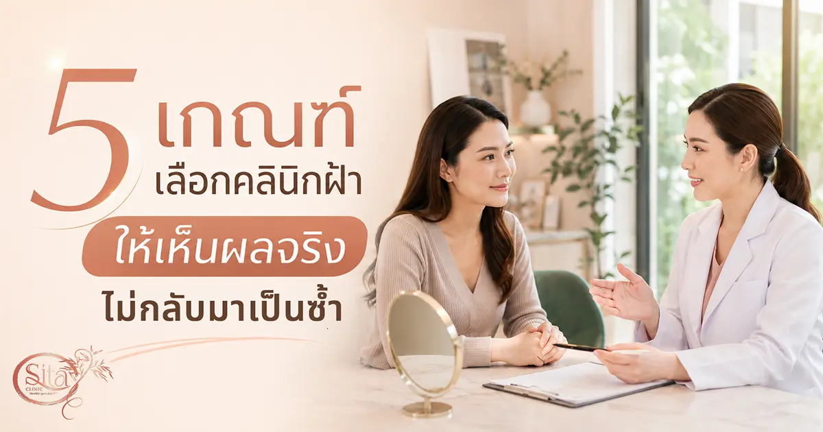 รักษาฝ้าที่ไหนดี 2026 5 เกณฑ์เลือกคลินิกรักษาฝ้าให้เห็นผลจริง ไม่กลับมาเป็นซ้ำ